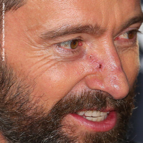 Hugh Jackman